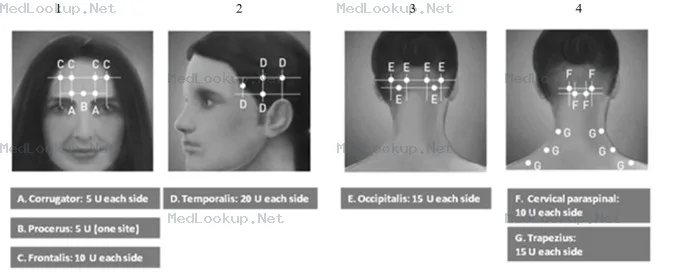 Botox Injection, Powder, Lyophilized, For Solution